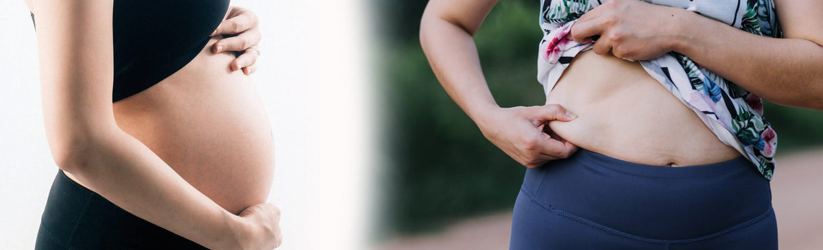 Abdominoplastie + lipo 360 + lifting des seins sans implants