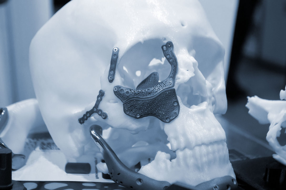 Chirurgie des traumatismes du visage